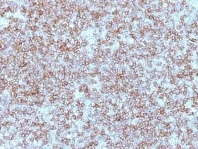 Immunohistochemistry-Paraffin: HLA DR/DP Antibody (Bra-14) - Azide and BSA Free [NBP2-48006]