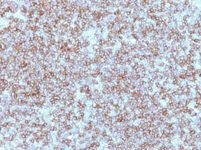 Immunohistochemistry-Paraffin: HLA DR/DP Antibody (Bra-14) - IHC-Prediluted [NBP2-48105]