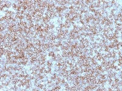 Immunohistochemistry-Paraffin: HLA DR/DP Antibody (Bra-14) [NBP2-44985]