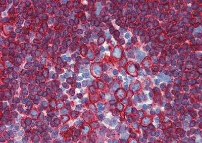 Immunohistochemistry-Paraffin: HLA DR/DP Antibody (HL-40) - BSA Free [NB500-408]