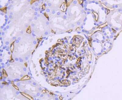 Immunohistochemistry-Paraffin: HLA DR/DP Antibody (SC06-78) [NBP2-67610]