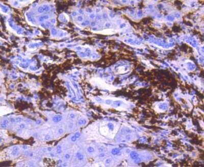 Immunohistochemistry-Paraffin: HLA DR/DP Antibody (SC06-78) [NBP2-67610]