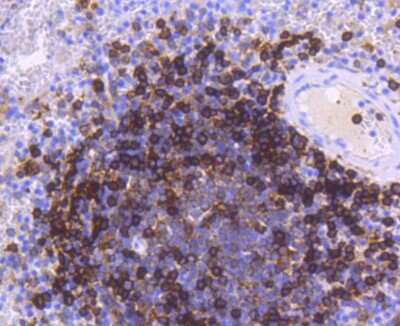 Immunohistochemistry-Paraffin: HLA DR/DP Antibody (SC06-78) [NBP2-67610]