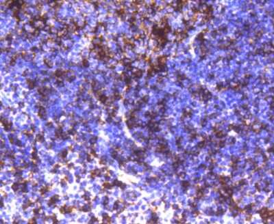 Immunohistochemistry-Paraffin: HLA DR/DP Antibody (SC06-78) [NBP2-67610]