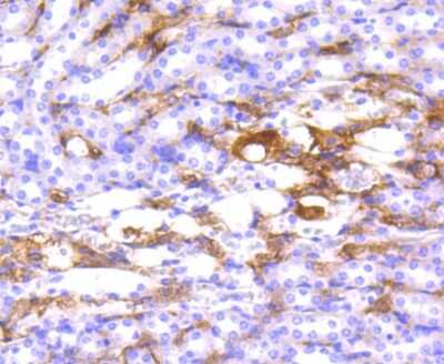 Immunohistochemistry-Paraffin: HLA DR/DP Antibody (SC06-78) [NBP2-67610]