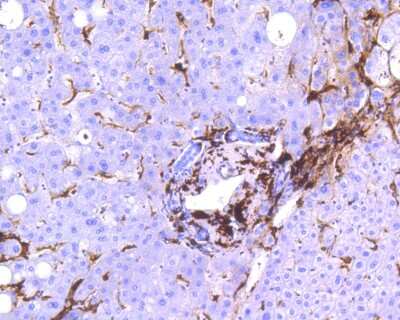 Immunohistochemistry-Paraffin: HLA DR/DP Antibody (SC06-78) [NBP2-67610]