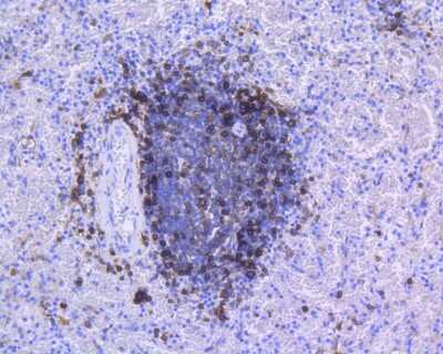 Immunohistochemistry-Paraffin: HLA DR/DP Antibody (SC06-78) [NBP2-67610]