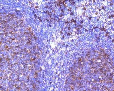 Immunohistochemistry-Paraffin: HLA DR/DP Antibody (SC06-78) [NBP2-67610]
