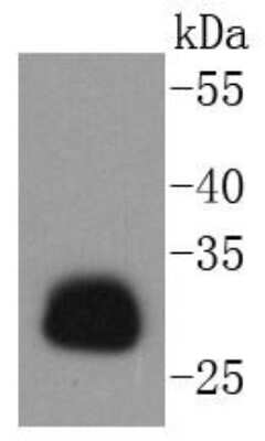 Western Blot: HLA DR/DP Antibody (SC06-78) [NBP2-67610]