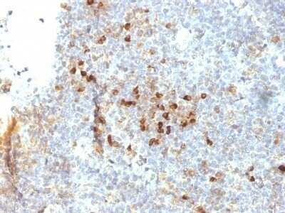 Immunohistochemistry-Paraffin: HLA DRA Antibody (19-26.1 (same as MB-26.1)) - IHC-Prediluted [NBP2-48106]