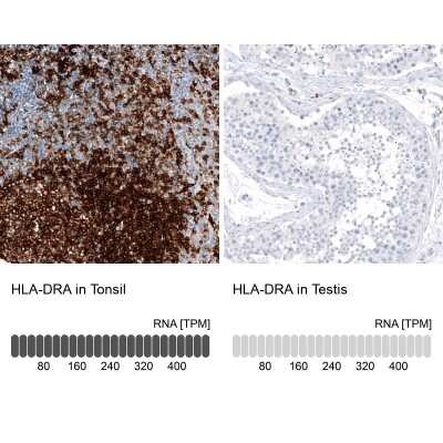 Immunohistochemistry-Paraffin: HLA DRA Antibody (CL10964) [NBP3-07996]