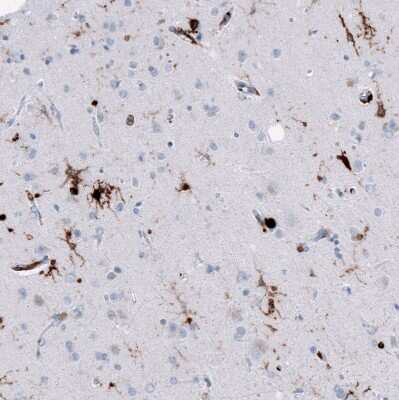 Immunohistochemistry-Paraffin: HLA DRA Antibody (CL10964) [NBP3-07996]