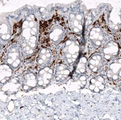 Immunohistochemistry-Paraffin: HLA DRA Antibody (CL10964) [NBP3-07996]