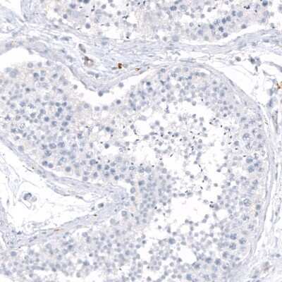 Immunohistochemistry-Paraffin: HLA DRA Antibody (CL10964) [NBP3-07996]