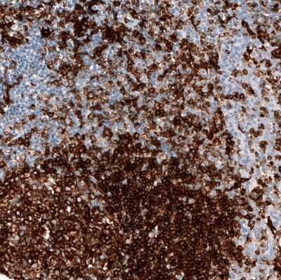 Immunohistochemistry-Paraffin: HLA DRA Antibody (CL10964) [NBP3-07996]