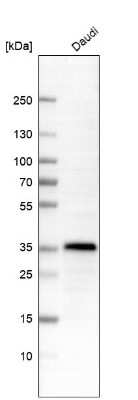 Western Blot: HLA DRA Antibody (CL10964) [NBP3-07996]