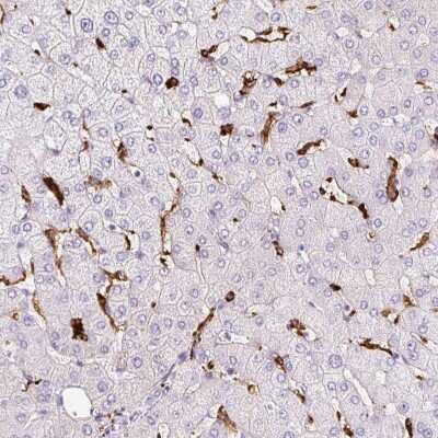 Immunohistochemistry-Paraffin: HLA DRA Antibody [NBP2-38619]