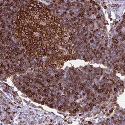 Immunohistochemistry-Paraffin: HLA DRA Antibody [NBP2-38619]