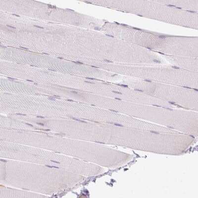 Immunohistochemistry-Paraffin: HLA DRA Antibody [NBP2-38619]