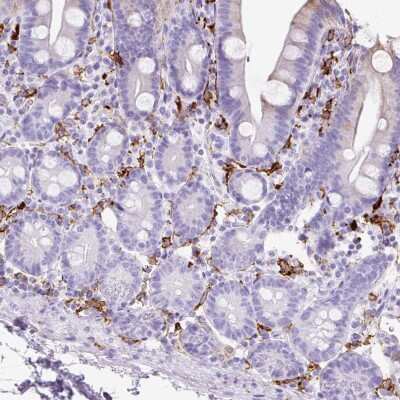 Immunohistochemistry-Paraffin: HLA DRA Antibody [NBP2-38619]