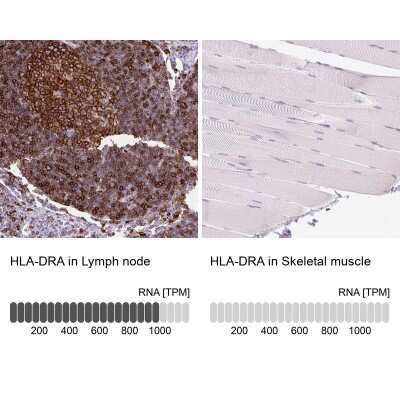 Immunohistochemistry-Paraffin: HLA DRA Antibody [NBP2-38619]