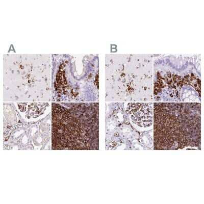 Immunohistochemistry-Paraffin: HLA DRA Antibody [NBP2-38619]
