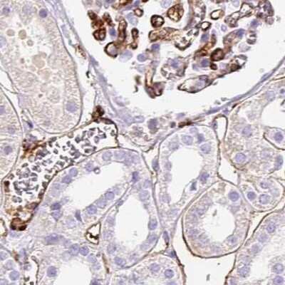 Immunohistochemistry-Paraffin: HLA DRA Antibody [NBP2-38619]