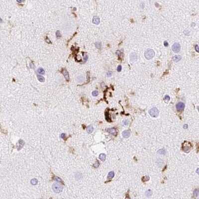 Immunohistochemistry-Paraffin: HLA DRA Antibody [NBP2-38619]
