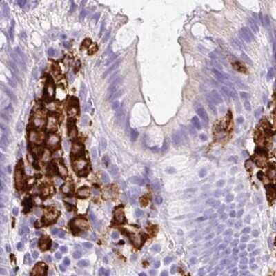 Immunohistochemistry-Paraffin: HLA DRA Antibody [NBP2-38619]