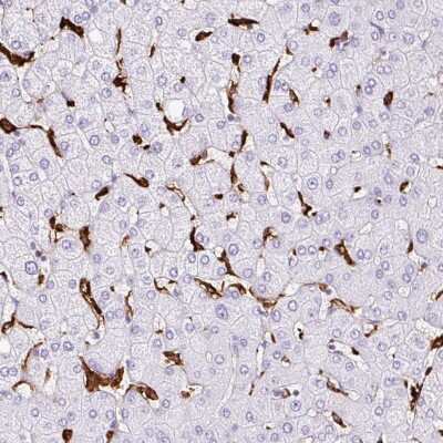 Immunohistochemistry-Paraffin: HLA DRA Antibody [NBP2-38691]