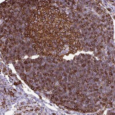 Immunohistochemistry-Paraffin: HLA DRA Antibody [NBP2-38691]