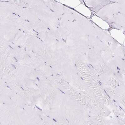 Immunohistochemistry-Paraffin: HLA DRA Antibody [NBP2-38691]
