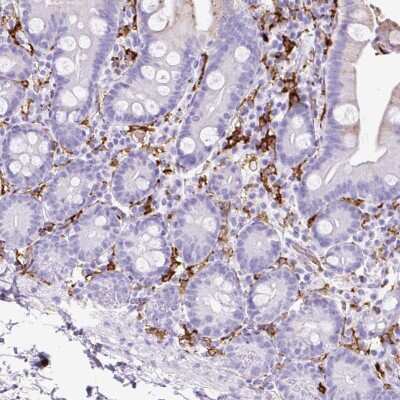 Immunohistochemistry-Paraffin: HLA DRA Antibody [NBP2-38691]