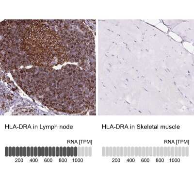 Immunohistochemistry-Paraffin: HLA DRA Antibody [NBP2-38691]