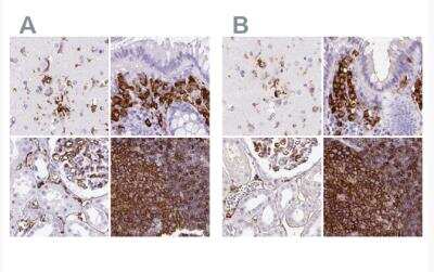 Immunohistochemistry-Paraffin: HLA DRA Antibody [NBP2-38691]