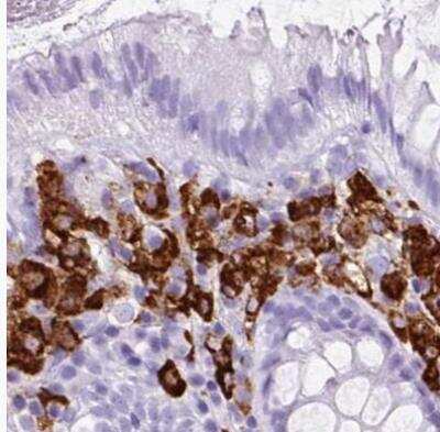 Immunohistochemistry-Paraffin: HLA DRA Antibody [NBP2-38691]