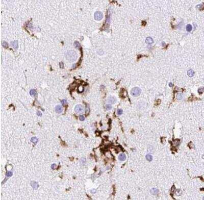 Immunohistochemistry-Paraffin: HLA DRA Antibody [NBP2-38691]
