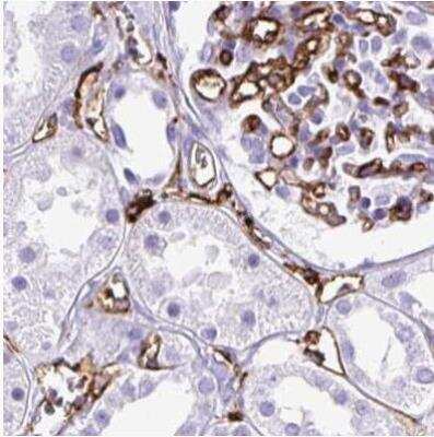 Immunohistochemistry-Paraffin: HLA DRA Antibody [NBP2-38691]