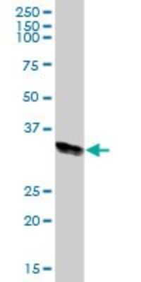 Western Blot: HLA DRA Antibody [H00003122-B01P]