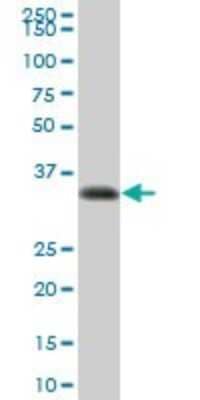 Western Blot: HLA DRA Antibody [H00003122-B01P]