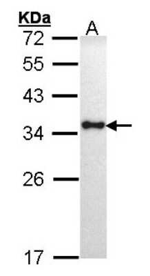 Western Blot: HLA DRA Antibody [NBP1-31512]