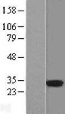 Western Blot: HLA DRA Overexpression Lysate [NBL1-11590]