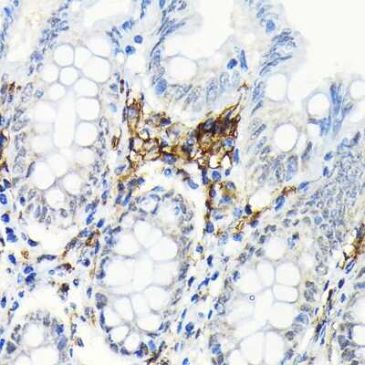 Immunohistochemistry-Paraffin: HLA DRB1 Antibody (6Z1F10) [NBP3-15950]