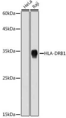 Western Blot: HLA DRB1 Antibody (6Z1F10) [NBP3-15950]