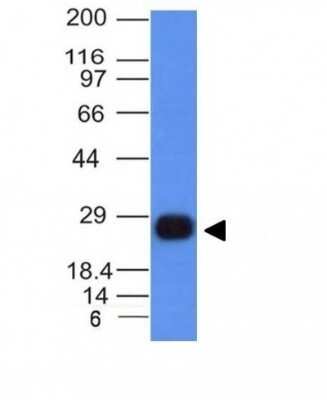 Western Blot: HLA DRB1 Antibody (HLA-DRB/1067)Azide and BSA Free [NBP2-47671]