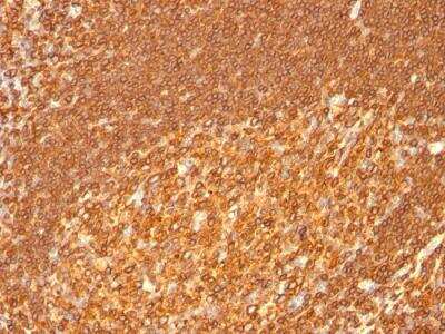 Immunohistochemistry-Paraffin: HLA DRB1 Antibody (HLA-DRB/1067) - IHC-Prediluted [NBP2-48135]