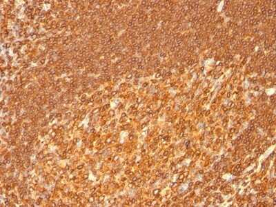 Immunohistochemistry-Paraffin: HLA DRB1 Antibody (HLA-DRB/1067) [NBP2-45314]