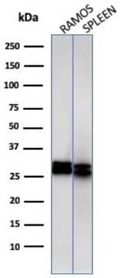 Western Blot: HLA DRB1 Antibody (HLA-DRB/1067) [NBP2-45314]