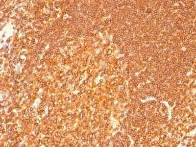 Immunohistochemistry-Paraffin: HLA DRB1 Antibody (LN-3 + HLA-DRB/1067) - Azide and BSA Free [NBP2-47672]