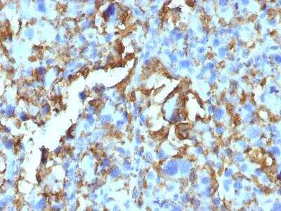 Immunohistochemistry-Paraffin: HLA DRB1 Antibody (LN-3 + HLA-DRB/1067) - IHC-Prediluted [NBP2-48136]